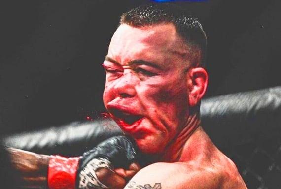 Top 5 Worst UFC Injuries of all time (in my opinion)