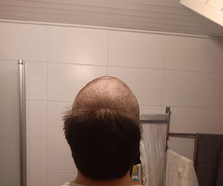 I said that if kape flukes a win over Royval I will go bald.