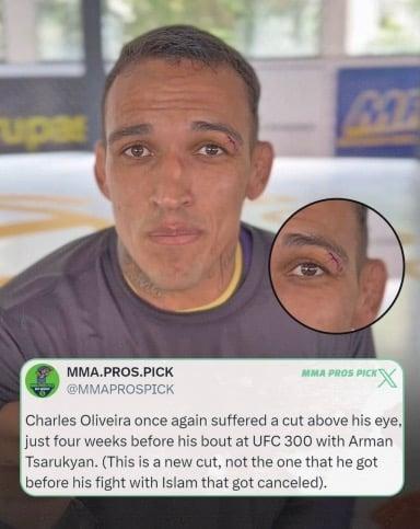 Since 2020, Charles Oliveira and Paulo Costa have pulled out of the exact same number of fights at 3. Will Charles become the new Pull Out King if he pulls out of the Arman fight due to another cut?
