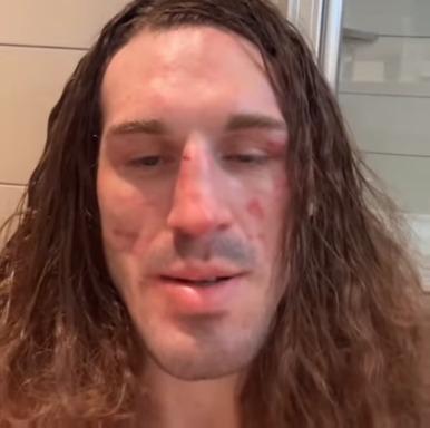 Imavov did not just beat Brendan Allen, he turned him into Brenda Allen 🤣