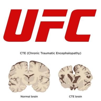 Is MMA About to Face a CTE Reckoning Like the NFL Did?