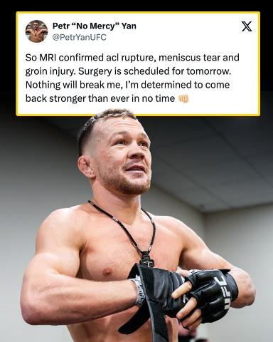 Petr Yan is set to undergo ACL reconstruction surgery. Recoveries for this surgery usually take 9 months to 1 year.