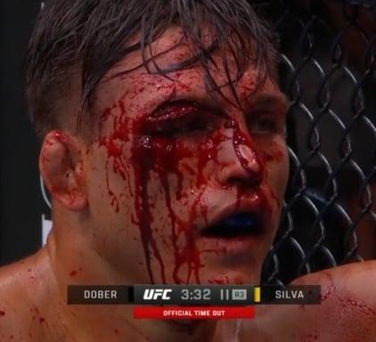 IS THIS ONE OF THE WORST CUTS WE HAVE EVER SEEN?