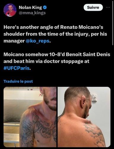 Moicano’s injury was nasty last night