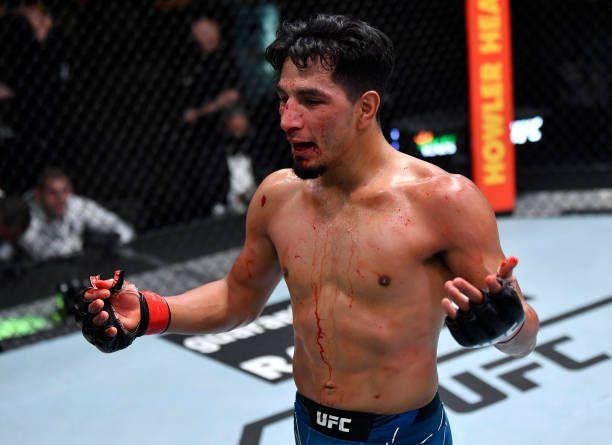 Adrian Yanez after his win against Randy Costa. Credits to: Jeff Bottari-Getty Images.