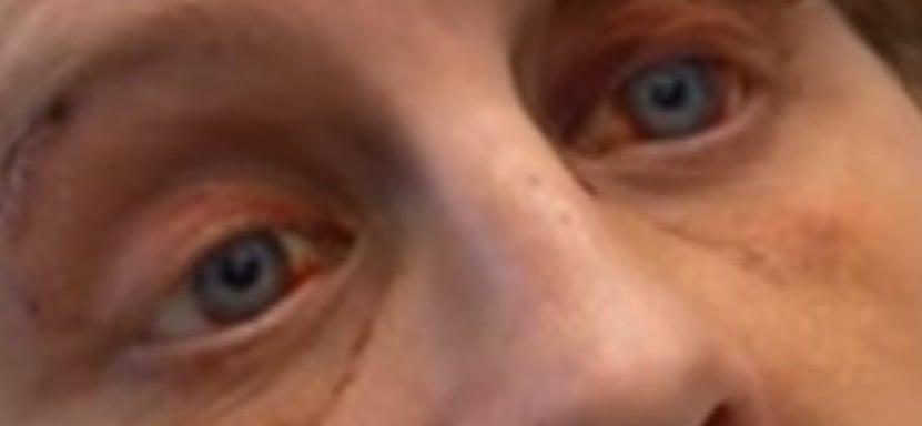 Eye pokes needs to be taken seriously. 