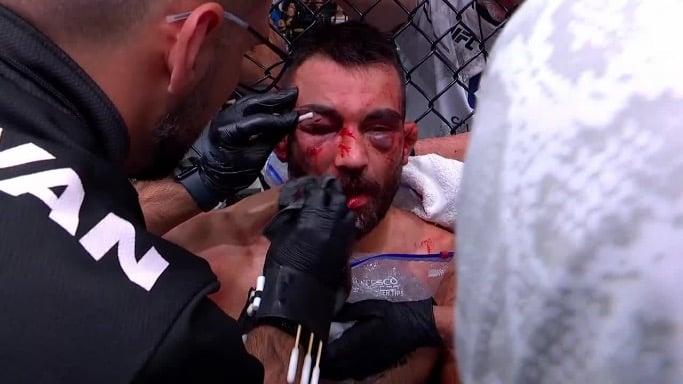 Moicano simply can’t afford to lose. What a scrap 