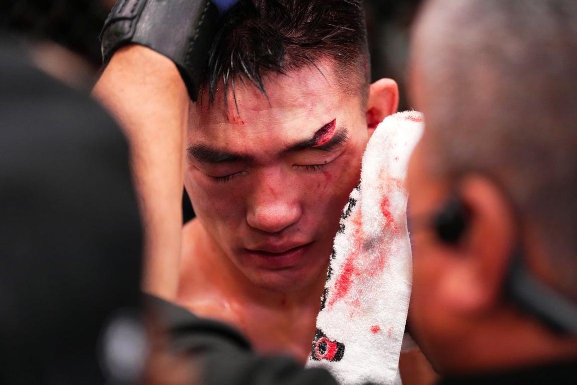 The main event was declared a doctor's stoppage because of a cut above Song Yadong's eye. Credits to: Chris Unger-Zuffa LLC