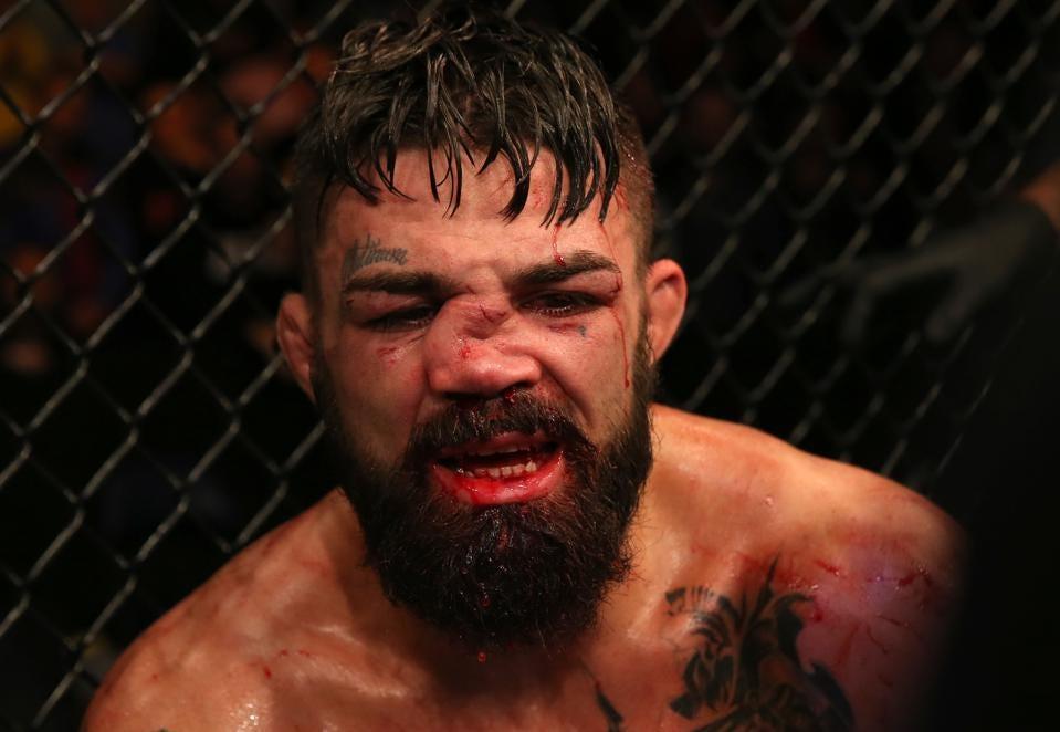 Mike Perry's nose took a beating in his fight with Vicente Luque. Photo by Forbes.