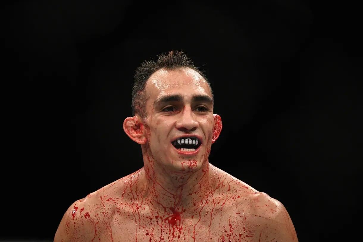 Tony Ferguson showcases a blood-covered smile. Credit: Harry How - Getty Images.
