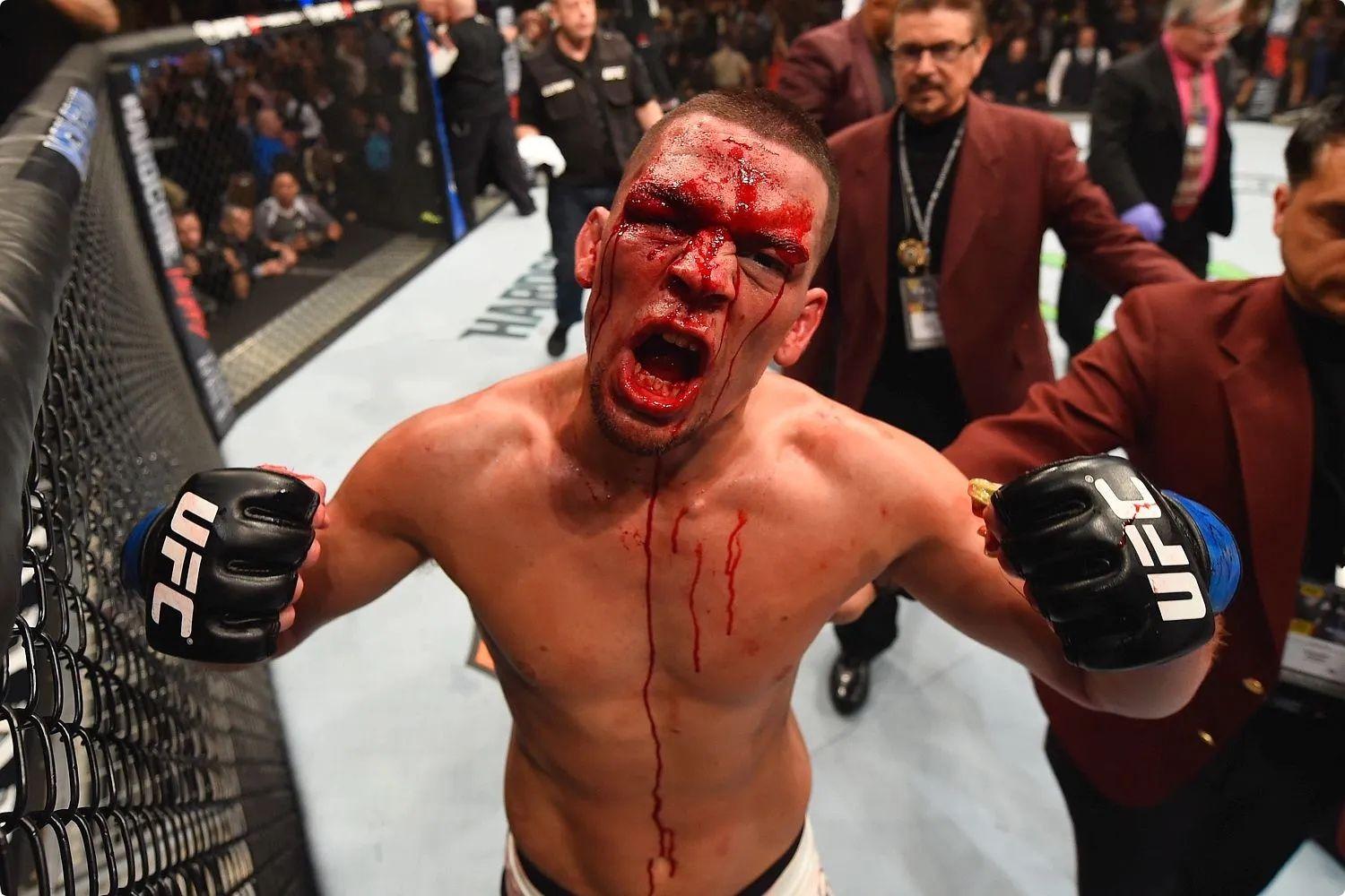 Top 10 Greatest Nate Diaz Moments